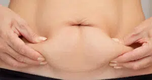 Woman with lower belly pooch