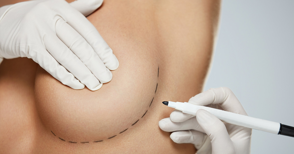 Breast Revision Surgery Cost