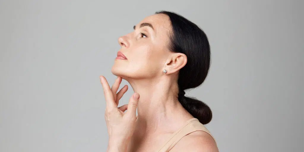 Woman with neck lines