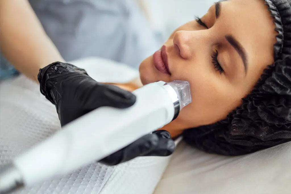 Clinician guiding a microneedling handpiece along a woman's jawline while she rests with her eyes closed