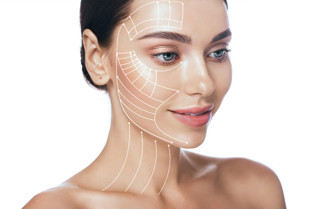 Woman's face overlaid with white arrows tracing upward lift lines across the cheek, jaw and neck